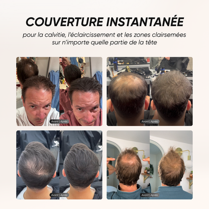 Camouflage capillaire + Sérum repousse et anti-chute